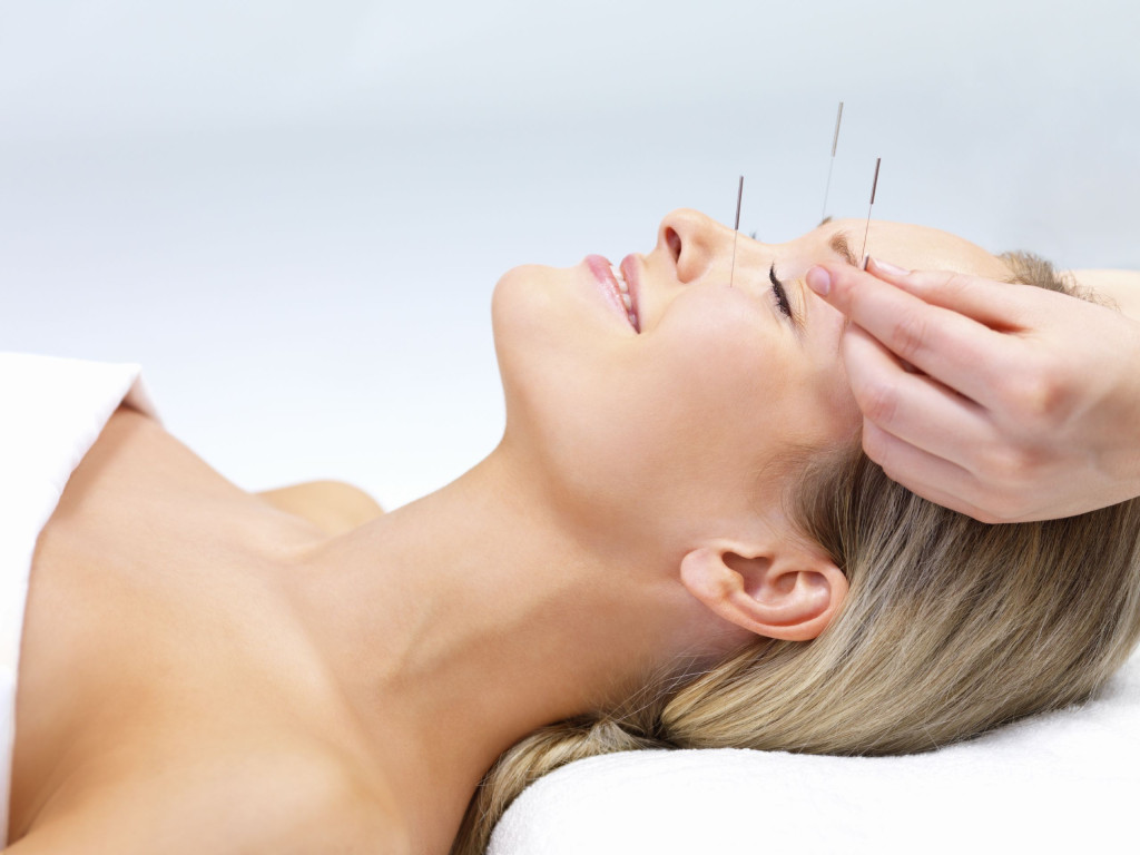 Acupuncture therapy - alternative medicine. Portrait of a beautiful woman in acupuncture therapy